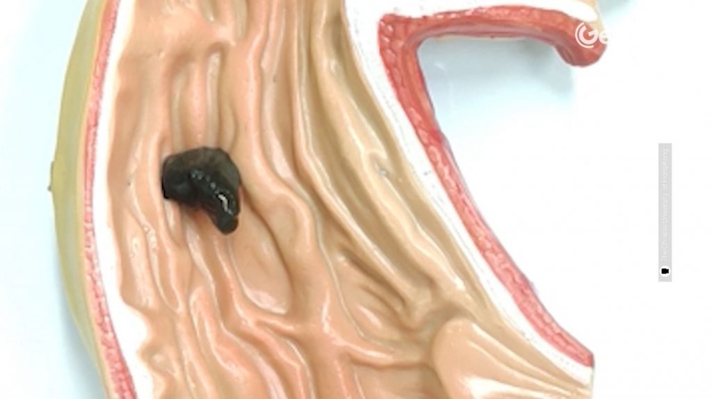 slime stomaco